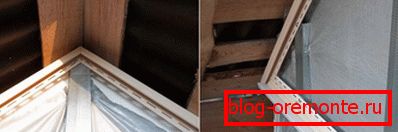 Зглобовите на ребрата